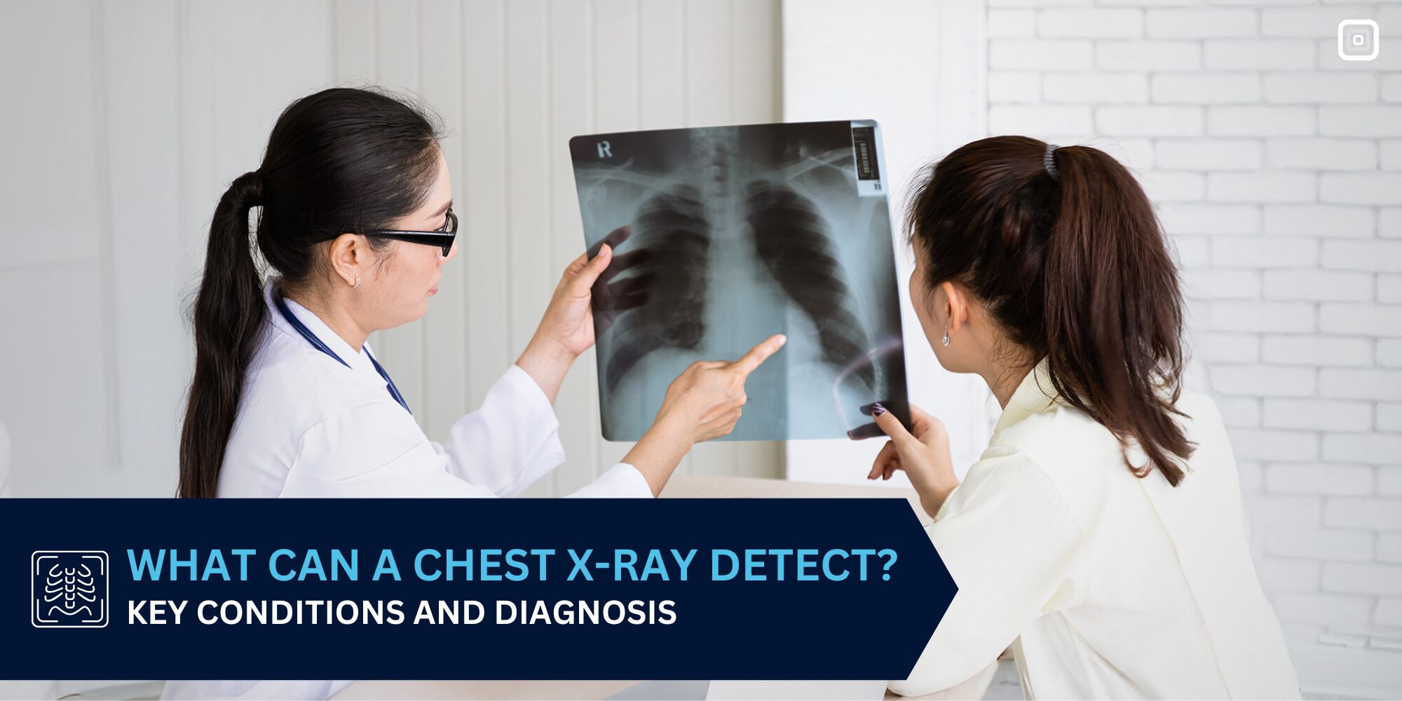 Chest X-Ray Insights: What It Can Reveal About Your Health